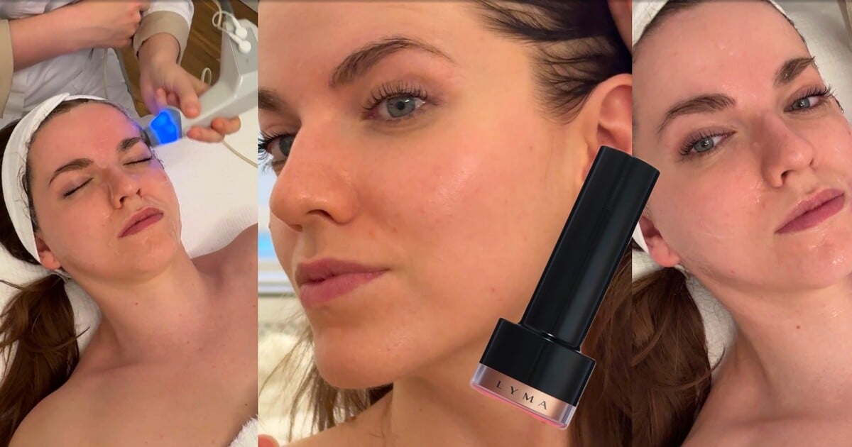 Celebrity na něj nedají dopustit. Lyma Laser můžeš vyzkoušet i v Praze