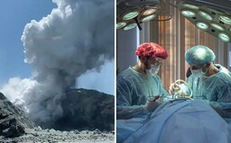 Doktoři na Novém Zélandu budou potřebovat 120 metrů čtverečních kůže. Důvodem jsou popáleniny po výbuchu sopky