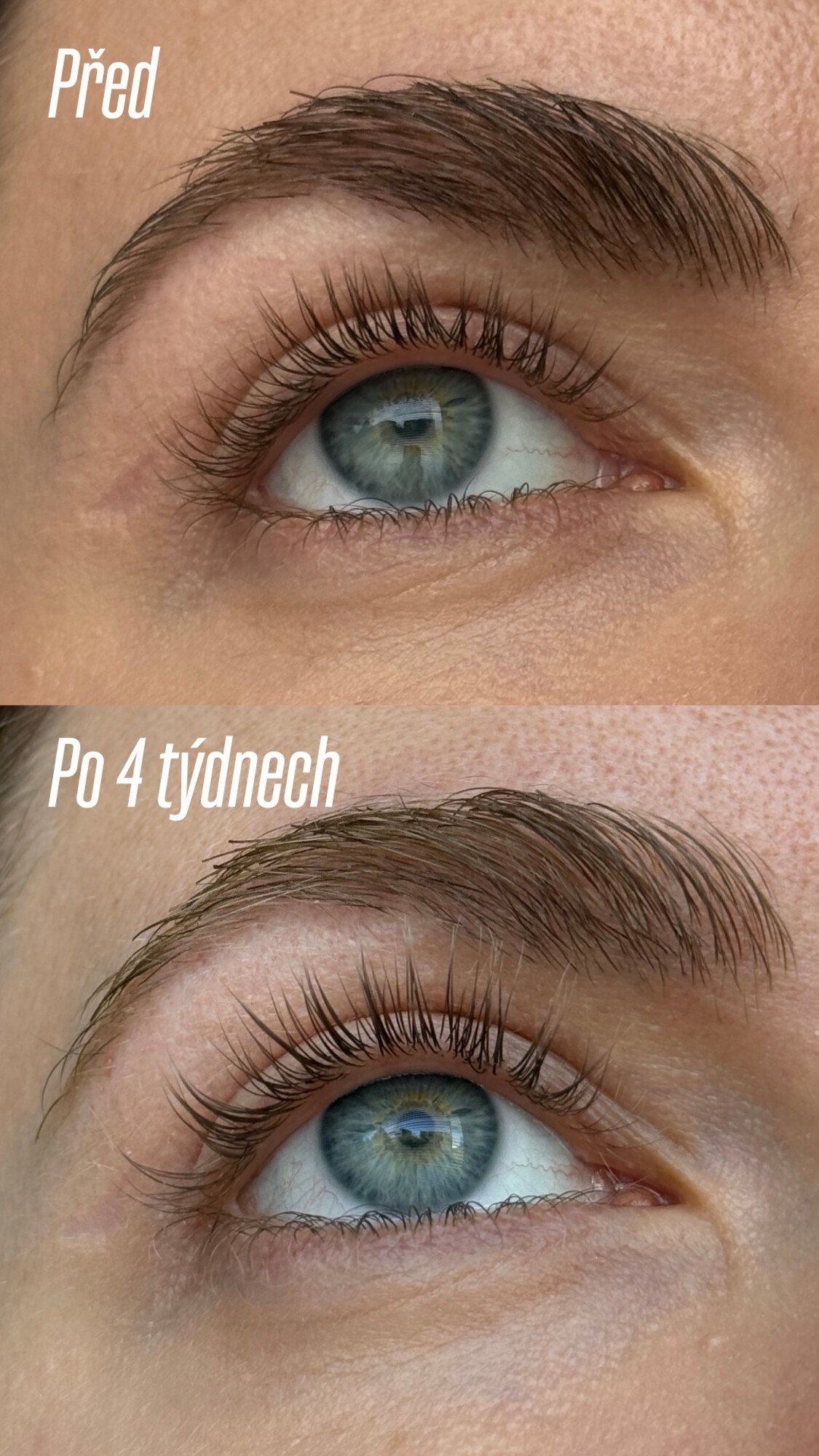 Serum na rasy z drogerie bez hormonu