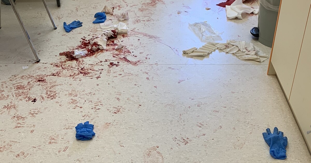 Útok mačetou: Toto jsou nové informace o zraněných, na které zaútočil muž v českobudějovické nemocnici