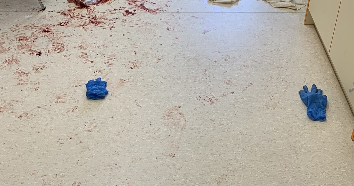 Útok mačetou: Muž, který útočil v nemocnici v Českých Budějovicích, je obviněn z těžkého ublížení na zdraví