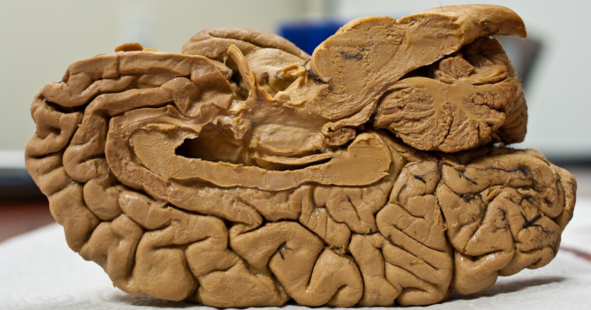 Muž zemřel kvůli mozkožroutské amébě. Nakazil se z kohoutkové vody