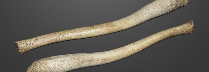I muži zřejmě někdy měli v pohlavních orgánech kost. Studie zjistila, že nás o ni pravděpodobně připravila evoluce