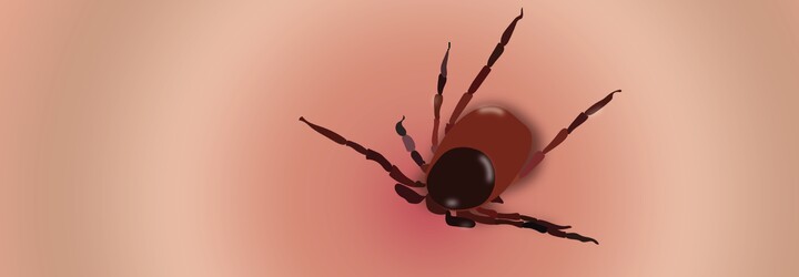 Neléčená borelióza vede k fatálním následkům. Rizikem je ale i falešná pozitivita a zbytečné nasazení antibiotik