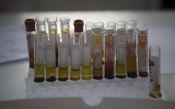 Exploze plynu v ruské laboratoři poškodila centrum se vzorky nebezpečných virů