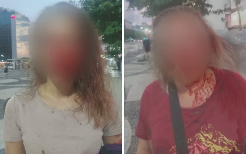 Slovenky počas dovolenky v Brazílii prežili drsný útok. Dvaja tínedžeri ich zmlátili do krvi, pretože im ženy odmietli dať peniaze.