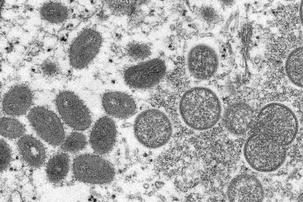 Na snímke z elektrónového mikroskopu v roku 2003, ktorú sprístupnilo Centrum pre kontrolu a prevenciu chorôb (CDC), sú zobrazené zrelé vírusové častice opičích kiahní oválneho tvaru (vľavo) a sférické nezrelé vírusové častice získané zo vzorky ľudskej kože (vpravo).