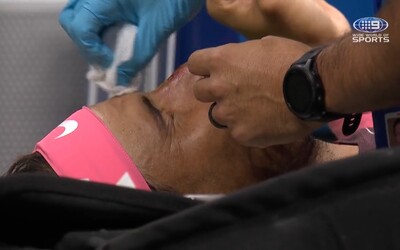 VIDEO: Rafael Nadal si na US Open rozbil nos vlastnou raketou. Krvavú ranu mu musel ošetriť zdravotník.