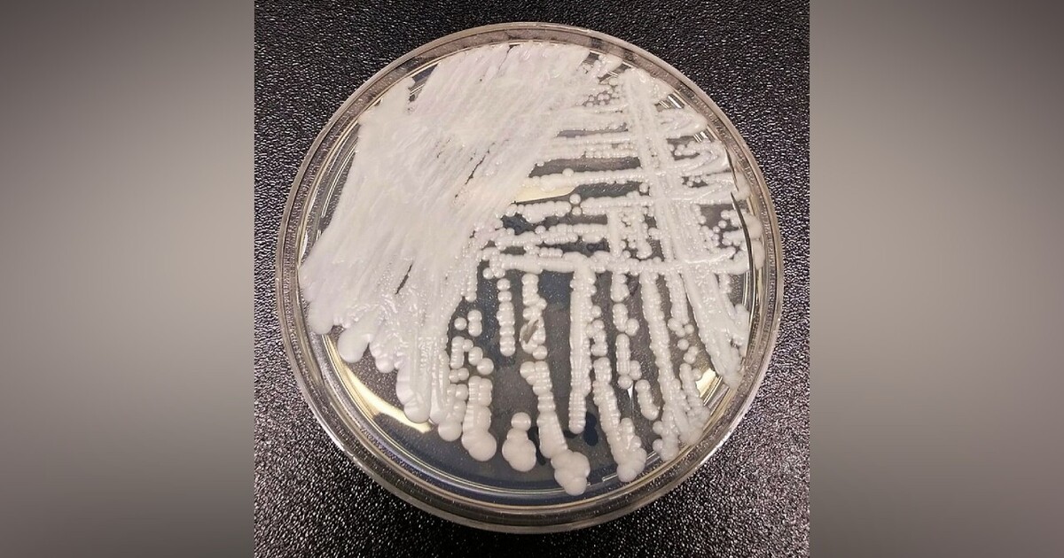 V amerických nemocnicích se šíří potenciálně smrtelná houba, napadá oslabené jedince