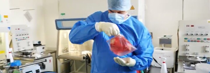 Lékaři z IKEMu provedli výjimečnou transplantaci. Mladý muž může žít normální život i bez slinivky