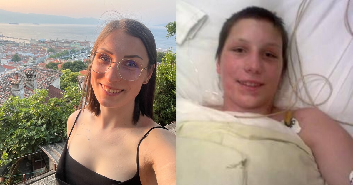 Broňa přežila zásah elektrickým proudem: „Viděla jsem své končetiny spálené až na kost“