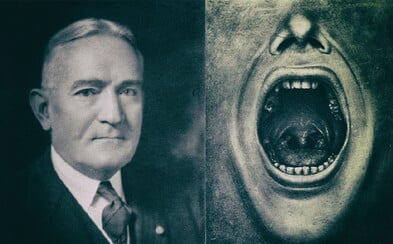 Henry Cotton: Duševne chorých pacientov liečil chirurgickými zákrokmi, ktoré pozostávali z odstraňovania žalúdka, zubov či čriev Henry Cotton: Duševne chorých pacientov liečil chirurgickými zákrokmi, ktoré pozostávali z odstraňovania žalúdka, zubov či čriev
