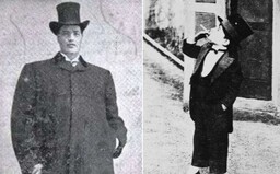 Historický unikát – z trpaslíka obrom. Pre raritnú poruchu prestal počuť na ľavé ucho a vidieť na pravé oko