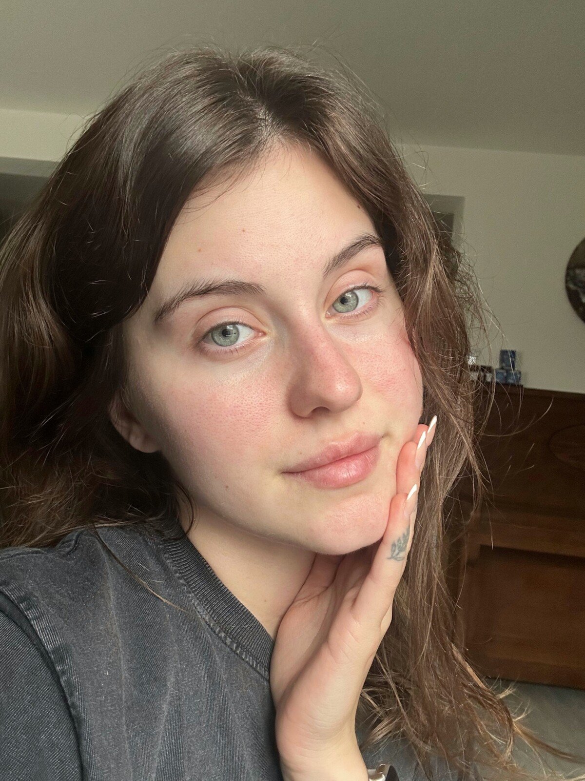 lip filler