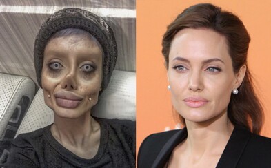 Iránčanka podstúpila už 50 plastických operácií, aby vyzerala ako Angelina Jolie. Ľudia si z nej namiesto toho uťahujú, že pripomína zombie Iránčanka podstúpila už 50 plastických operácií, aby vyzerala ako Angelina Jolie. Ľudia si z nej namiesto toho uťahujú, že pripomína zombie
