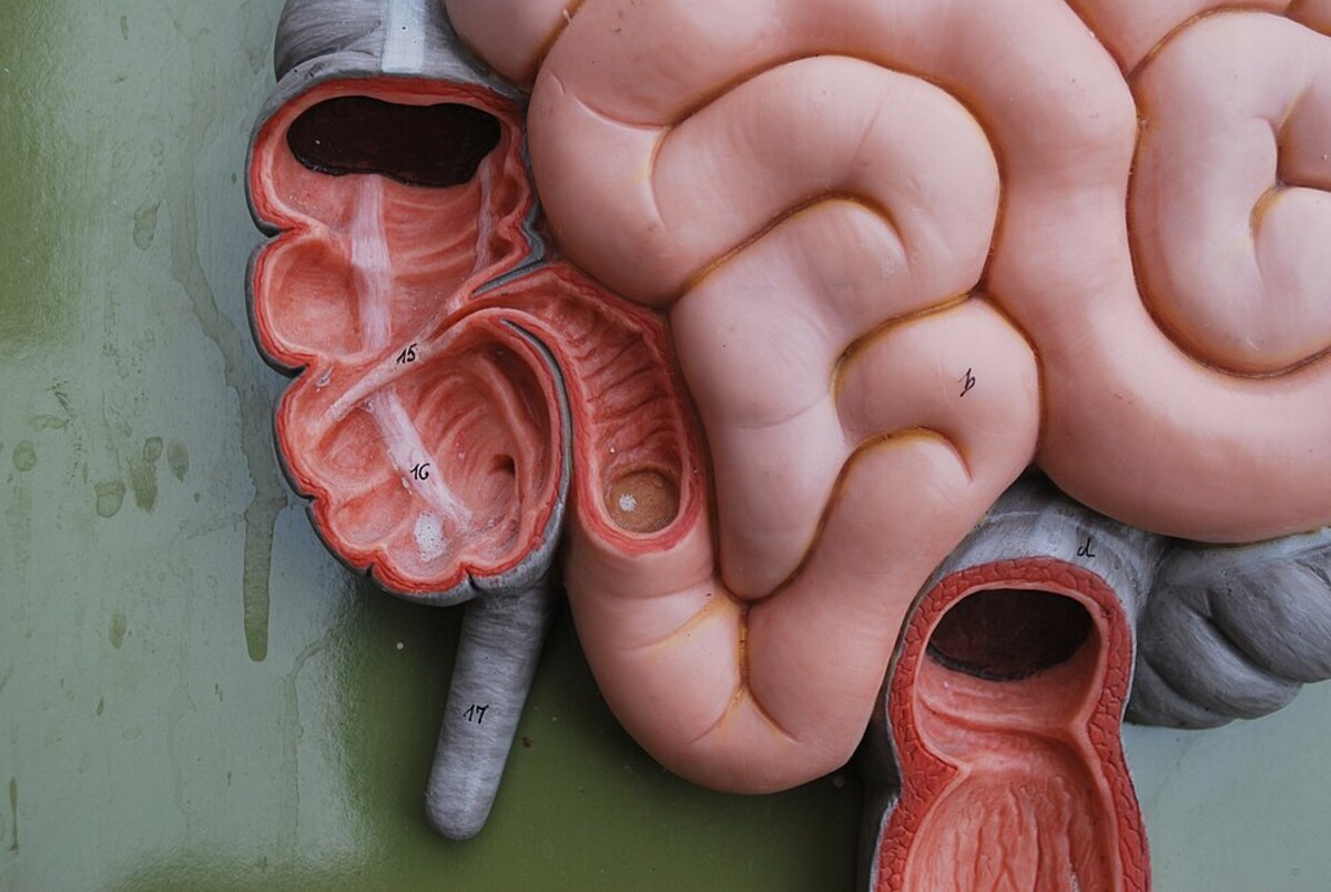 travenie, crevo, slepe crevo