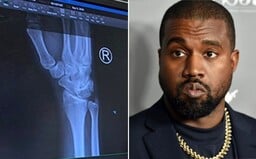 Kanye West měl bolesti ruky, natočil video, jak mu píchají injekc: Příliš mnoho psaní na telefonu, brácho