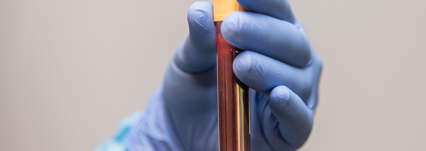 Kauza Theranos: Exředitel Balwani byl odsouzen ke 13 letům vězení