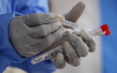 Koronavírus môže mať úmrtnosť pod 0,2 %. V USA sa totiž nakazilo výrazne viac ľudí, než ukazujú oficiálne štatistiky Koronavírus môže mať úmrtnosť pod 0,2 %. V USA sa totiž nakazilo výrazne viac ľudí, než ukazujú oficiálne štatistiky