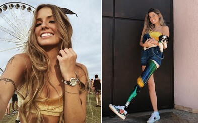 Krásná Brazilka s amputovanou nohou inspiruje lidi po celém světě. I přes handicap se usmívá a denně sportuje Krásná Brazilka s amputovanou nohou inspiruje lidi po celém světě. I přes handicap se usmívá a denně sportuje