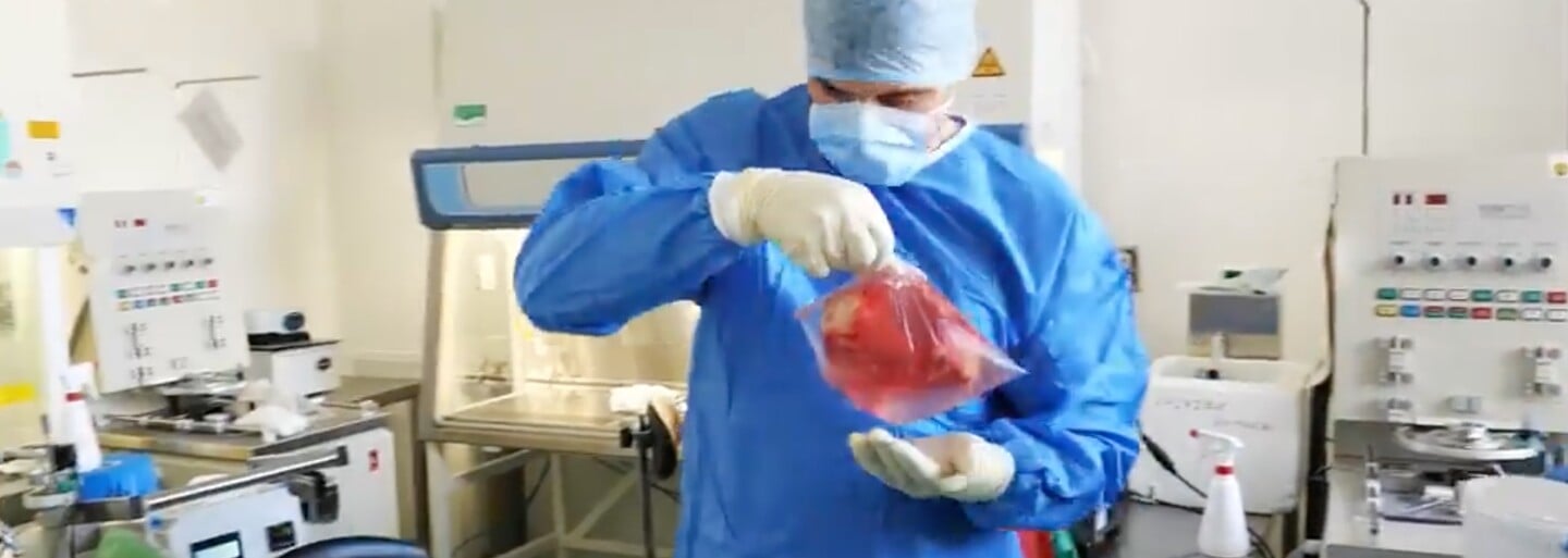 Lékaři z IKEMu provedli výjimečnou transplantaci. Mladý muž může žít normální život i bez slinivky
