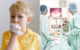 Ľudia, ktorí necítia bolesť: nemajú problém odhryznúť si jazyk alebo kráčať na zlomenej nohe, no zvyčajne sa nedožijú dospelosti