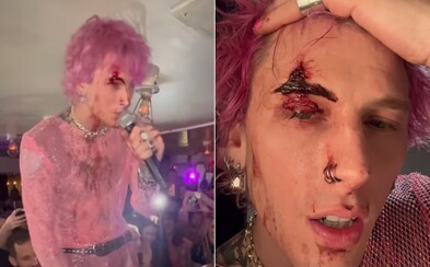 Machine Gun Kelly Smashed A Glass Of Champagne Against His Face During A Concert. His Bloody Face Did Not Interrupt The Concert Machine Gun Kelly Smashed A Glass Of Champagne Against His Face During A Concert. His Bloody Face Did Not Interrupt The Concert