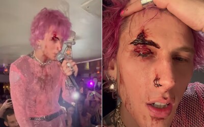 Machine Gun Kelly Smashed A Glass Of Champagne Against His Face During A Concert. His Bloody Face Did Not Interrupt The Concert 