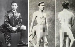 Making History With Three Legs and Two Genitals. The Story of Famous Italian Showman, Frank Lentini.
