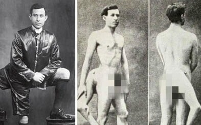 Making History With Three Legs and Two Genitals. The Story of Famous Italian Showman, Frank Lentini. Making History With Three Legs and Two Genitals. The Story of Famous Italian Showman, Frank Lentini.