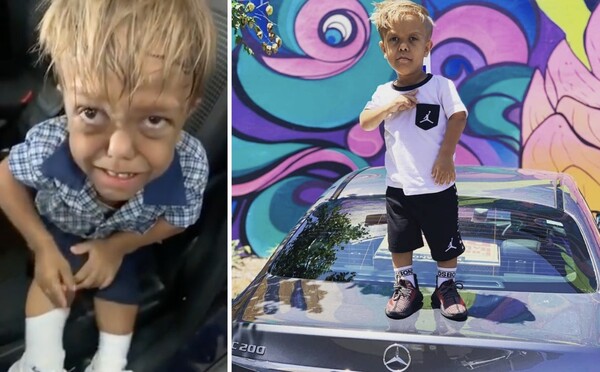 Malý Quaden trpiaci dwarfizmom spustil vlnu hoaxov. Internet klame, že má 18 rokov a je instagramovou celebritou
