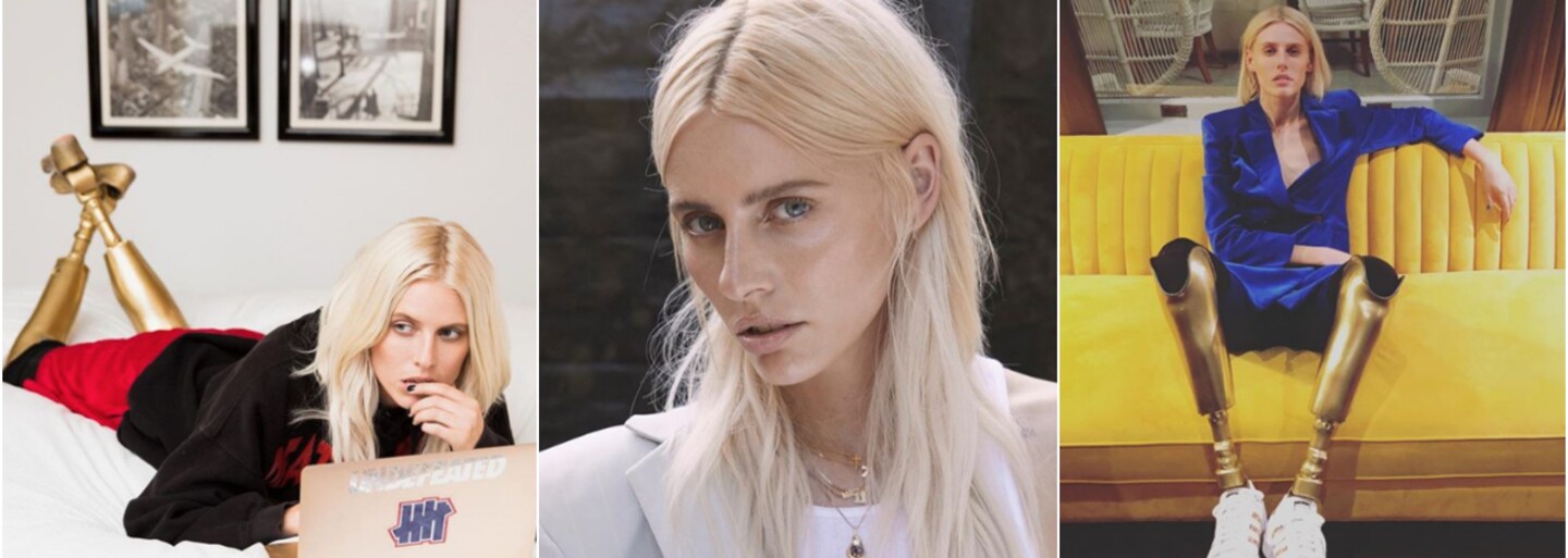 Matka se před amputací připravovala na její pohřeb, Lauren se ale nakonec dostala do Vogue