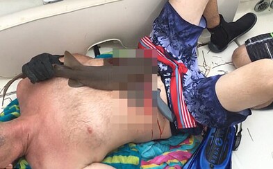 Muži se žralok zakousl do břicha a dlouhé minuty se odmítal pustit. Zvíře museli ubodat, aby stisk zubů povolilo Muži se žralok zakousl do břicha a dlouhé minuty se odmítal pustit. Zvíře museli ubodat, aby stisk zubů povolilo