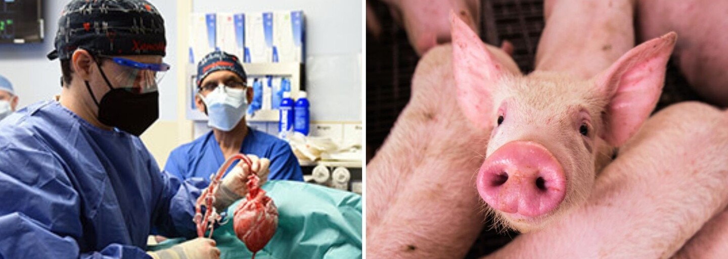 Muži transplantovali prasečí srdce a zachránili mu tím život. Jedná se o první podobnou operaci na světě