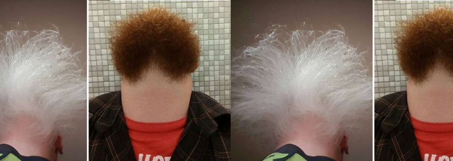 Na čo sa to pozeráš? Nový trend fotenia svojej brady zo spodu začal rozosmievať internet