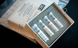 Němečtí výzkumníci testují lék, který by mohl zabránit šíření koronaviru