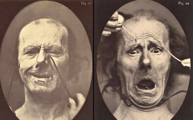 Nepríjemné výrazy ľudí po zásahu striedavým prúdom priamo do tváre. História pozná aj podobné bizarnosti Nepríjemné výrazy ľudí po zásahu striedavým prúdom priamo do tváre. História pozná aj podobné bizarnosti
