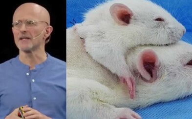 Na tělo potkana přišil hlavu myši. Chirurg, kterého čeká první transplantace lidské hlavy, trénink nezanedbává Na tělo potkana přišil hlavu myši. Chirurg, kterého čeká první transplantace lidské hlavy, trénink nezanedbává