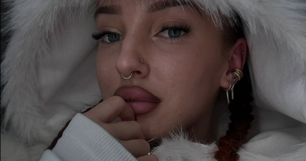 Problém, o kterém se nemluví. Fitness influencerka otevřeně o hemoroidech, na operaci musela v 21 letech