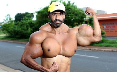 Podľahol syntholu a prezývajú ho brazílsky Hulk. Valdir je však so sebou spokojný a chce byť ešte väčší Podľahol syntholu a prezývajú ho brazílsky Hulk. Valdir je však so sebou spokojný a chce byť ešte väčší