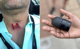 Policajt v USA strelil reportéra počas rozhovoru priamo do krku. Protestujúci sa sťažujú na brutálne zákroky