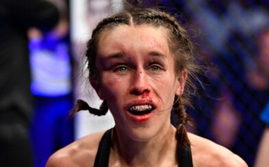 Polská UFC bojovnice, jejíž obličej při posledním zápase otekl k nepoznání, se zotavila Polská UFC bojovnice, jejíž obličej při posledním zápase otekl k nepoznání, se zotavila