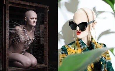 Postavila sa modelingovým stereotypom a porazila ich. Melanie trpí vzácnou genetickou poruchou, ale práve kvôli nej sa stala úspešnou modelkou Postavila sa modelingovým stereotypom a porazila ich. Melanie trpí vzácnou genetickou poruchou, ale práve kvôli nej sa stala úspešnou modelkou