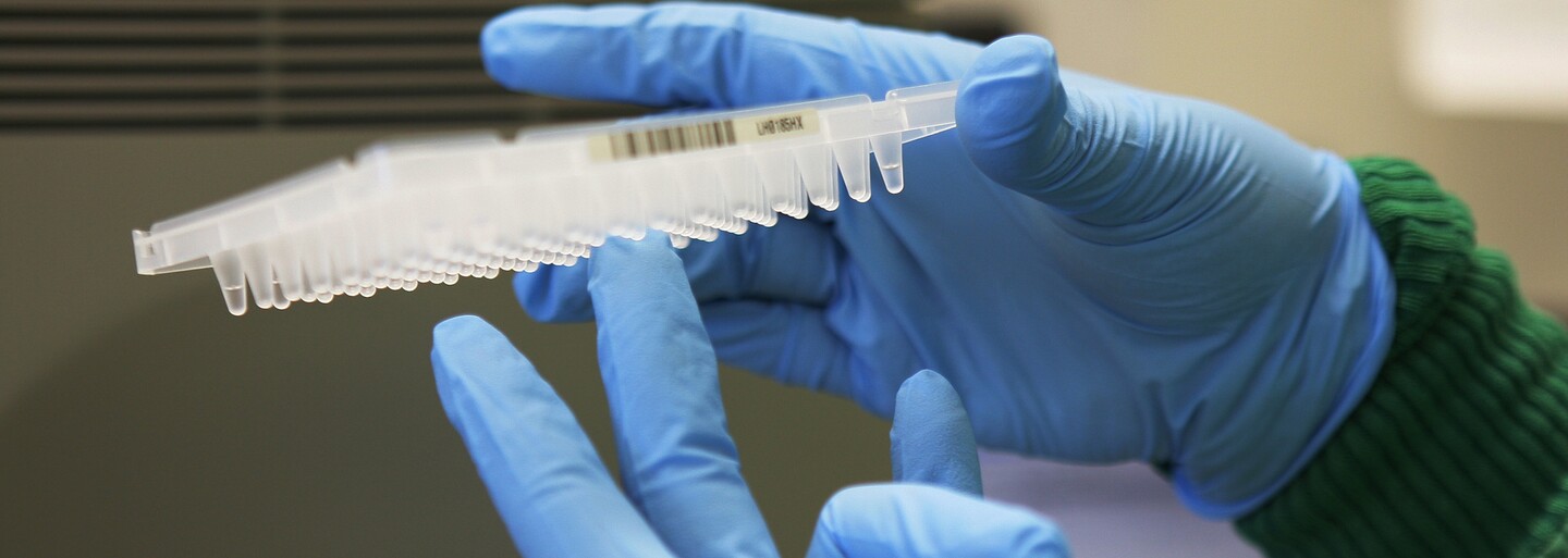 Pozreli sme sa do laboratória, kde sa testujú odobraté vzorky na koronavírus