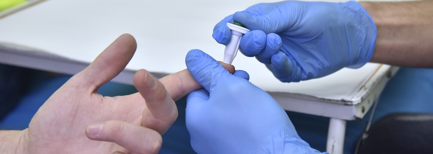 Provozuješ nechráněný sex nebo se prostě jen rád cítíš v bezpečí? Takto probíhá HIV testování (Reportáž)