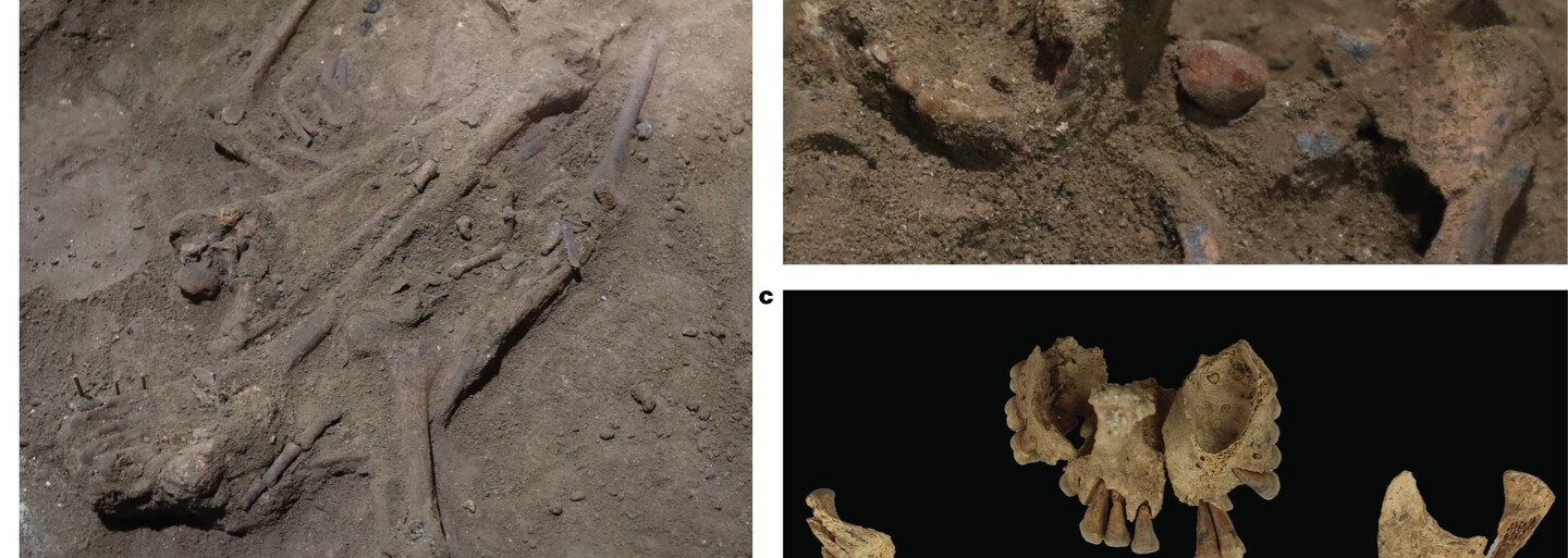 První chirurgická operace byla provedena před více než 30 tisíci lety, šlo o amputaci nohy