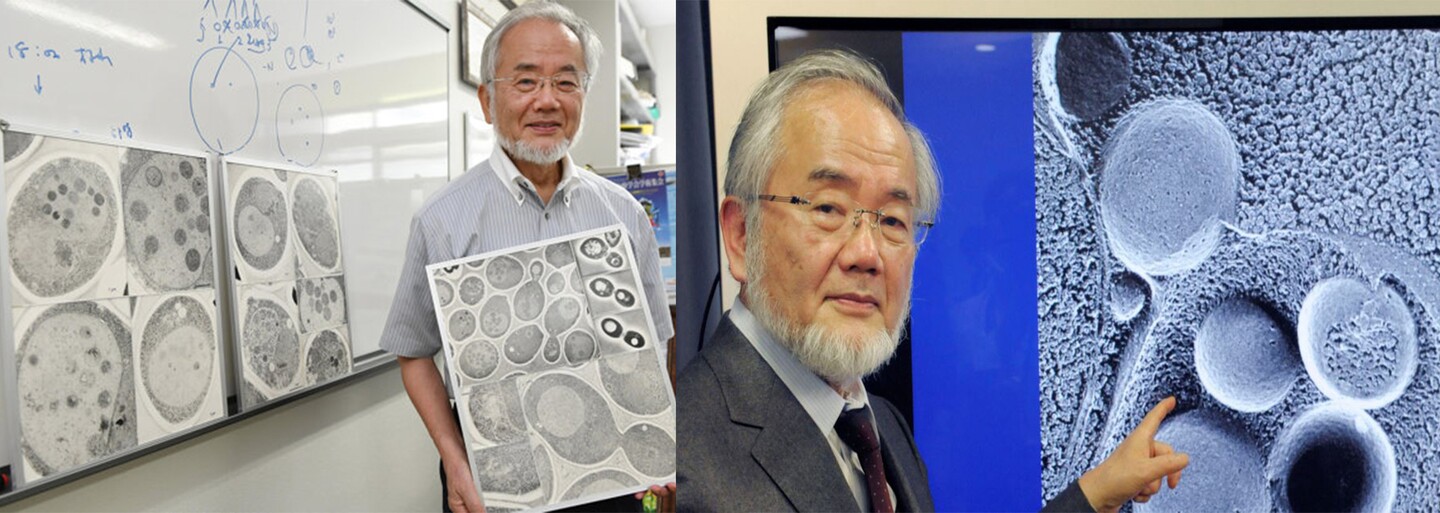 První Nobelovu cenu dnes získal japonský vědec Jošinori Ohsumi. Objasnil proces, jak se buňky opravují