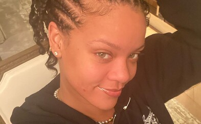 Rihanna pritvrdzuje v boji za prirodzenú krásu, na prvej fotke v novom roku ukazuje vyrážku Rihanna pritvrdzuje v boji za prirodzenú krásu, na prvej fotke v novom roku ukazuje vyrážku