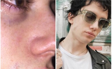 Samey představuje cover ke svému debutovému sólu. Zobrazuje na něm upřímnou emoci na detailech vlastní tváře Samey představuje cover ke svému debutovému sólu. Zobrazuje na něm upřímnou emoci na detailech vlastní tváře