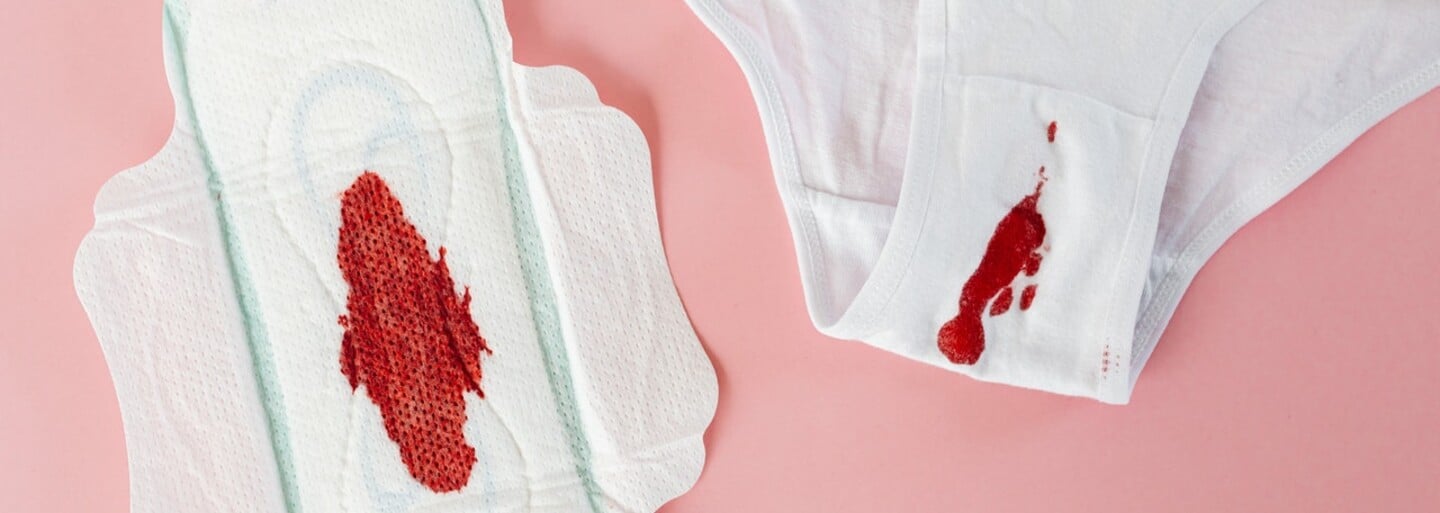 Skotsko: Úředník pro důstojnou menstruaci je cis muž. To je snad vtip, říkají ti, kteří skutečně menstruují